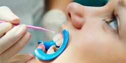 A woman receiving a fluoride varnish.