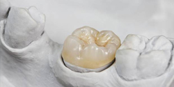 Dental crown