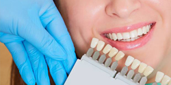 Woman getting matched for a dental crown