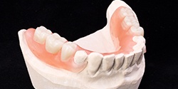 Model smile with partial denture