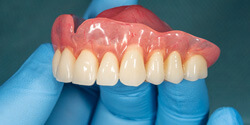 a gloved hand holding an upper denture