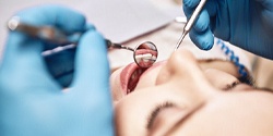 Denton cosmetic dentist placing direct bonding in Denton