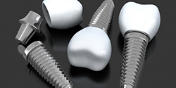 three dental implants with abutments and crowns 
