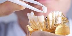 dentist placing a crown on top of a dental implant