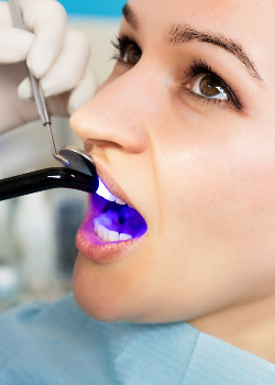 Hands applying UV light to woman’s tooth-colored filling