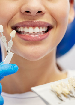 Nose-to-neck view of woman smiling with shade guide held to her teeth
