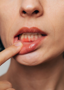 A woman with gum disease near Shady Shores