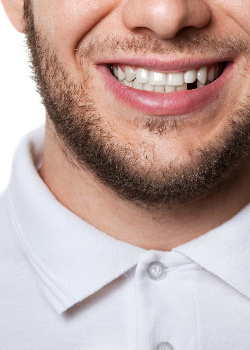 A man missing a tooth near Shady Shores