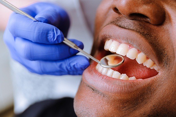Man having teeth checked