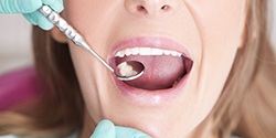 Woman with mouth open getting examined