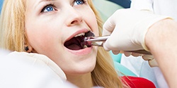 A woman receiving a tooth extraction