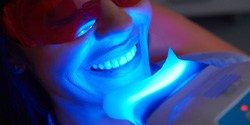 Woman undergoing professional teeth whitening in Denton, TX