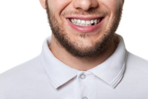 man smiling with missing tooth