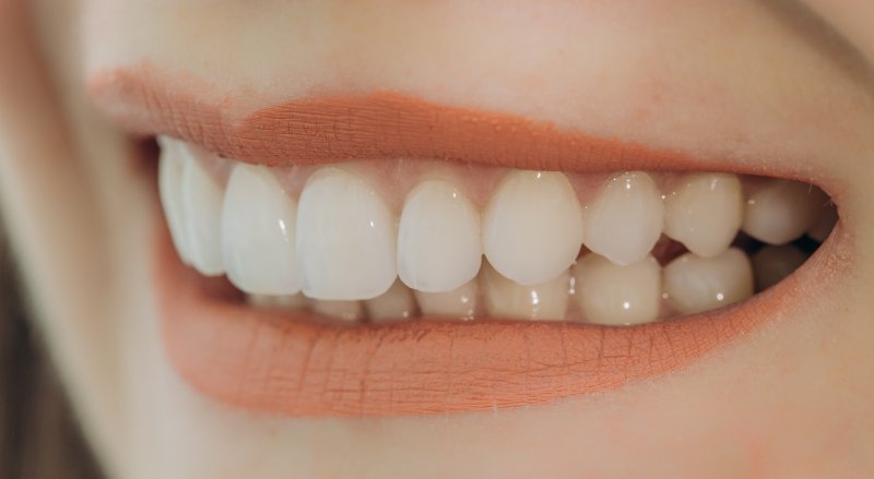 Woman with porcelain veneers in Denton smiling