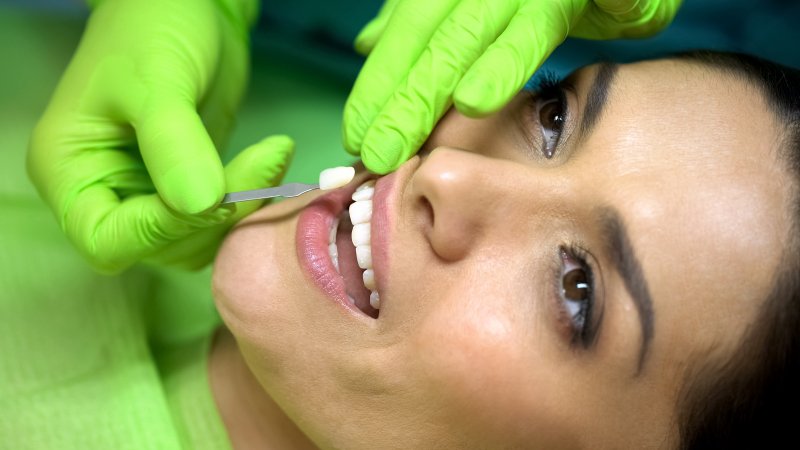 Woman smiling with veneers