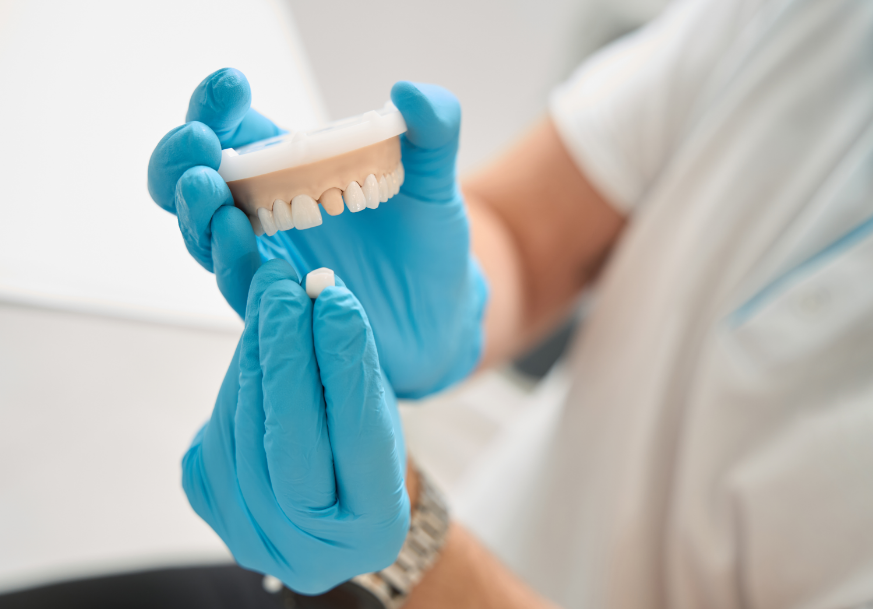 Dentist holding dental crown mold