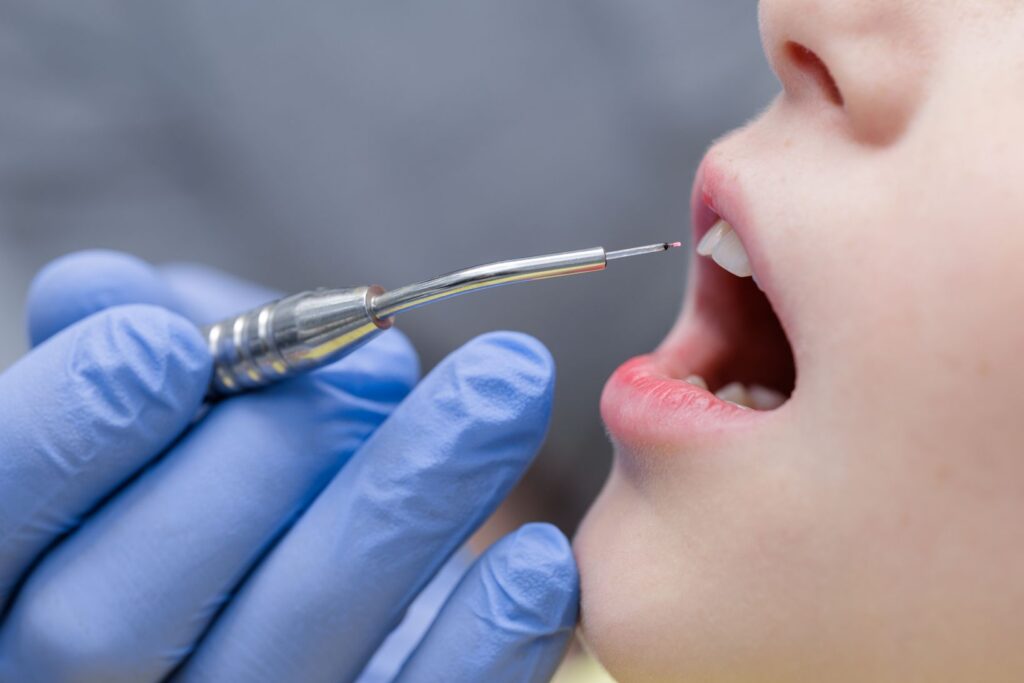 A soft tissue laser treating a patient’s mouth